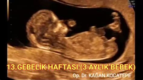 3 aylık gebelik ultrason görüntüleri